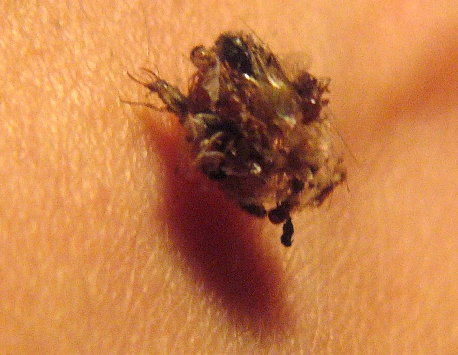 Larva di Pseudomallada sp.